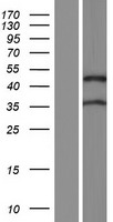 ZFYVE27 Human Over-expression Lysate