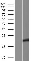TMEM239 Human Over-expression Lysate