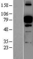 Periostin (POSTN) Human Over-expression Lysate