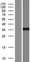 Cardiac Troponin T (TNNT2) Human Over-expression Lysate