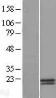 JPT1 Human Over-expression Lysate