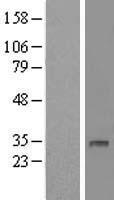 DHRS12 Human Over-expression Lysate