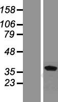 Renalase (RNLS) Human Over-expression Lysate