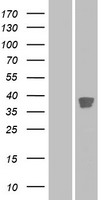 CCRK (CDK20) Human Over-expression Lysate