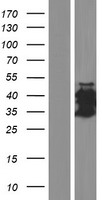 CT47A3 Human Over-expression Lysate