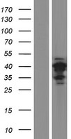 CT47A7 Human Over-expression Lysate