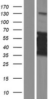 CT47A8 Human Over-expression Lysate