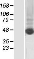 Keratin 80 (KRT80) Human Over-expression Lysate