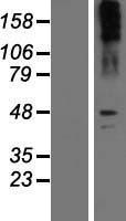 Noradrenaline transporter (SLC6A2) Human Over-expression Lysate