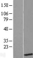 UBL5 Human Over-expression Lysate