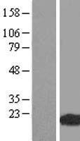 WHAMMP3 Human Over-expression Lysate