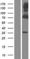 cGKI (PRKG1) Human Over-expression Lysate