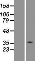 GPR18 Human Over-expression Lysate