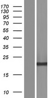 CSTP1 (CPPED1) Human Over-expression Lysate