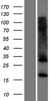 CYBC1 Human Over-expression Lysate