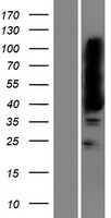 MAGEB16 Human Over-expression Lysate