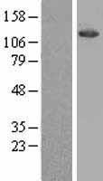 ATP citrate lyase (ACLY) Human Over-expression Lysate