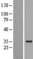DECR1 Human Over-expression Lysate