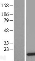 DDT Human Over-expression Lysate