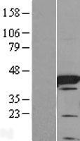 FABP6 Human Over-expression Lysate