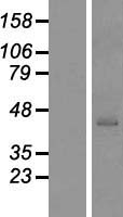 GTF2H2 Human Over-expression Lysate