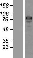 IKK beta (IKBKB) Human Over-expression Lysate