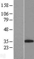 CD8A Human Over-expression Lysate
