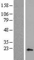 DLX4 Human Over-expression Lysate