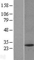 PAFAH1B2 Human Over-expression Lysate