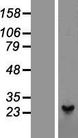 Peroxiredoxin 1 (PRDX1) Human Over-expression Lysate