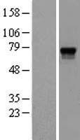 Proprotein Convertase 2 (PCSK2) Human Over-expression Lysate