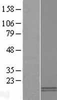PF4V1 Human Over-expression Lysate