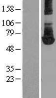 PKM2 (PKM) Human Over-expression Lysate