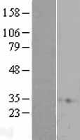 RAP1A Human Over-expression Lysate