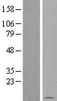 SDHD Human Over-expression Lysate