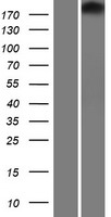TJP1 Human Over-expression Lysate