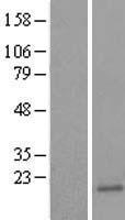 UBE2B Human Over-expression Lysate