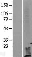 DPM2 Human Over-expression Lysate