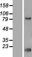 TRIP13 Human Over-expression Lysate