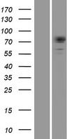 Dystrophia myotonica protein kinase (DMPK) Human Over-expression Lysate