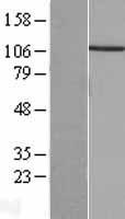 PP4R1 (PPP4R1) Human Over-expression Lysate