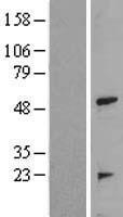 TRIP (TRAIP) Human Over-expression Lysate