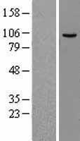 MCM4 Human Over-expression Lysate