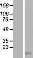 S100 Calcium Binding Protein A13 (S100A13) Human Over-expression Lysate