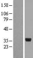 Cyclophilin E (PPIE) Human Over-expression Lysate