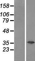 GAL4 (LGALS4) Human Over-expression Lysate