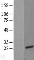 Neurotensin (NTS) Human Over-expression Lysate