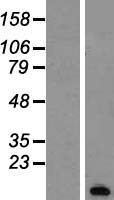 PCP4 Human Over-expression Lysate