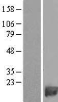 PDE6H Human Over-expression Lysate
