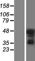 PKC delta (PRKCD) Human Over-expression Lysate